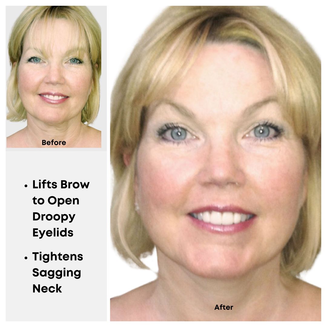 Instant Face Lift