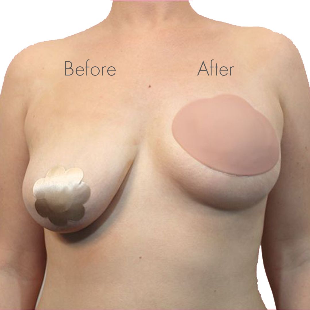 Breast Shapers™ Nude – Comfortable Lift in A/B & C/D Sizes