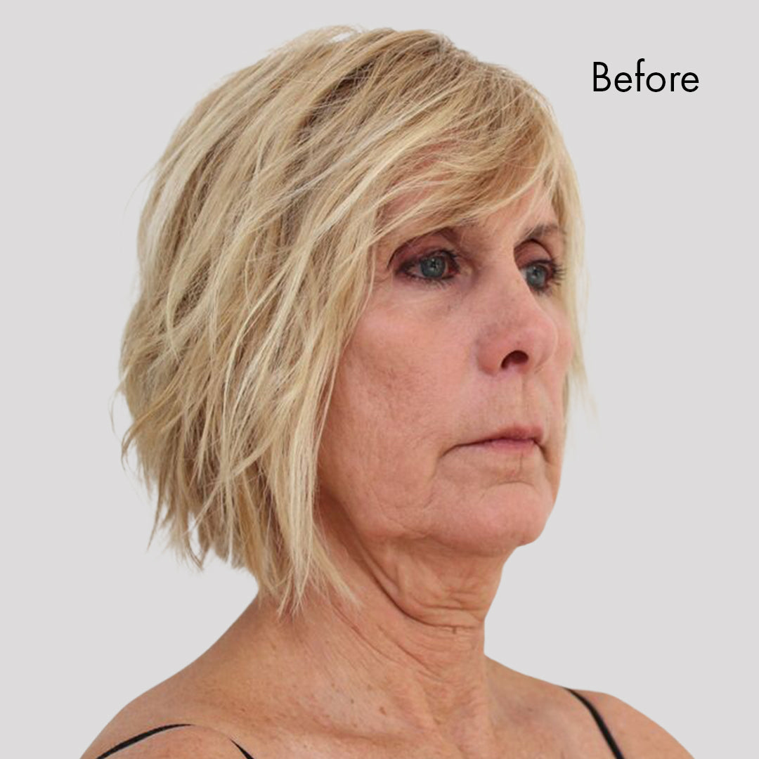 Instant Face Lift