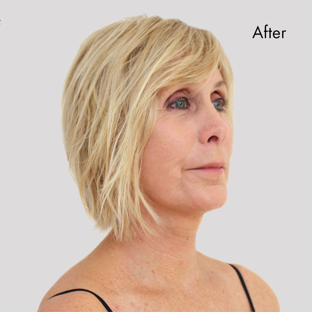 Instant Face Lift